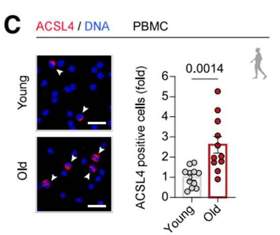 老年人比年轻人有更多的ACSL4。红色标记为ACSL4，蓝色标记为DNA。（参考资料[1]）